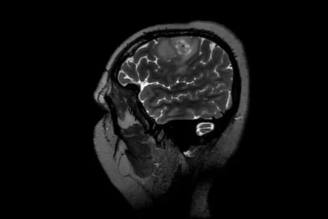 Computed resonance imaging of the human brain. Stock Photos