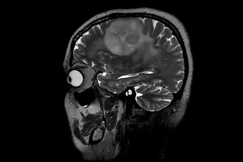 Computed resonance imaging of the human brain. Stock Photos