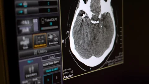 Computed Tomography Of The Brain In The Clinic Stock Footage 276742144