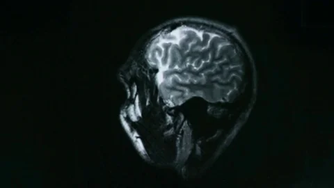 Computed tomography of the brain Stock Footage 69902137