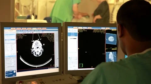 Computed Tomography - CT Computed Axial Tomography - CAT Vidéo 63161793