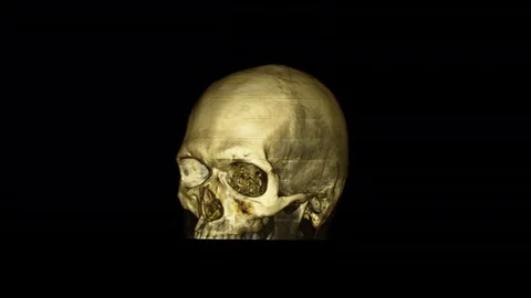 Computed tomography Stock Footage 81484522