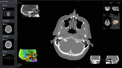 Computed tomography of the head. Video stock 165910895