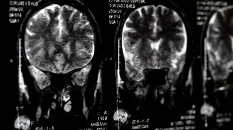 Computed tomography in motion clouse up Stock Footage 44620235