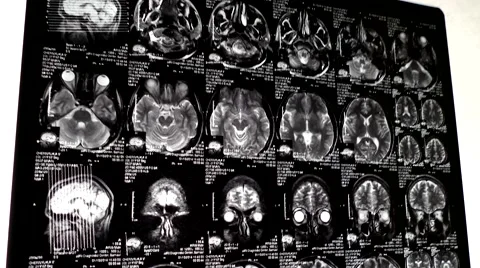 Computed tomography in motion dolly shot Stock Footage 44620555
