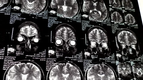 Computed tomography in motion dolly shot out Stock Footage 44621022