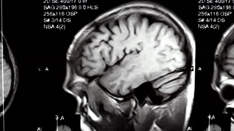 Computed tomography in motion dolly shot Stock Footage 44621276