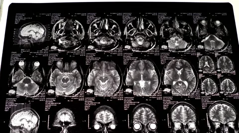 Computed tomography in motion Video stock 44557621