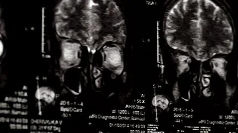 Computed tomography in motion Video stock 44620072