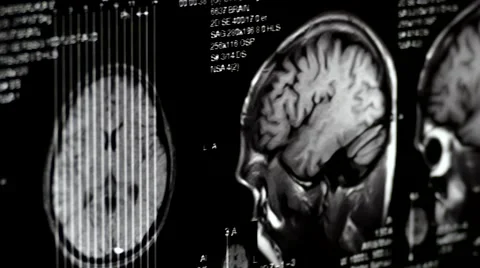 Computed tomography in motion Video stock 44620077