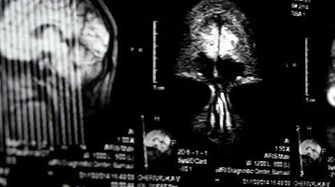 Computed tomography in motion Video stock 44620092