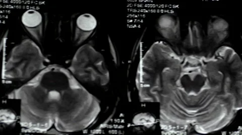 Computed tomography in motion Video stock 44620166