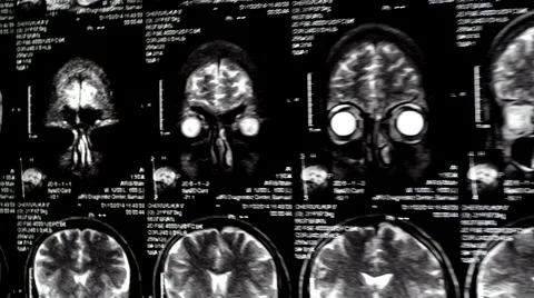 Computed tomography in motion Video stock 44620221