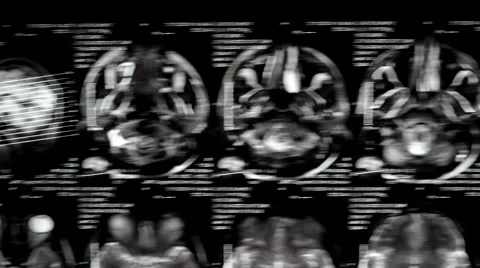 Computed tomography in motion Video stock 44620414
