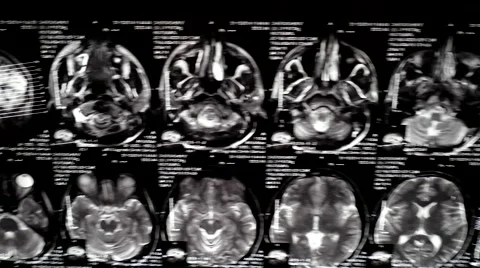 Computed tomography in motion Stock Footage 44620430