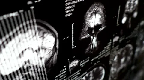 Computed tomography in motion Video stock 44620485