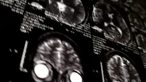 Computed tomography in motion Stock Footage 44620526