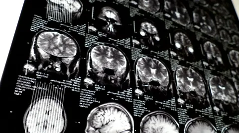 Computed tomography in motion Video stock 44620549