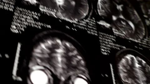 Computed tomography in motion Stock Footage 44620563