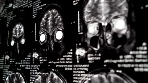 Computed tomography in motion Stock Footage 44620613