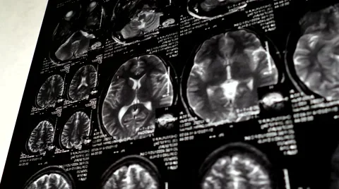 Computed tomography in motion Stock Footage 44620650