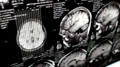 Computed tomography in motion Stock Footage 44620662