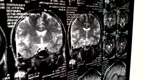 Computed tomography in motion Stock Footage 44620802