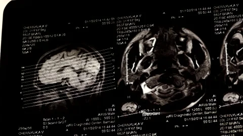 Computed tomography in motion Stock Footage 44620865