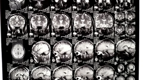 Computed tomography in motion Stock Footage 44620876