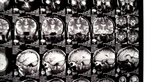 Computed tomography in motion Stock Footage 44620909