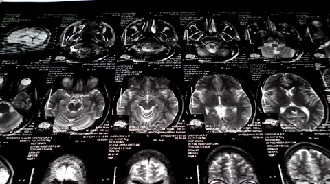 Computed tomography in motion Stock Footage 44620942