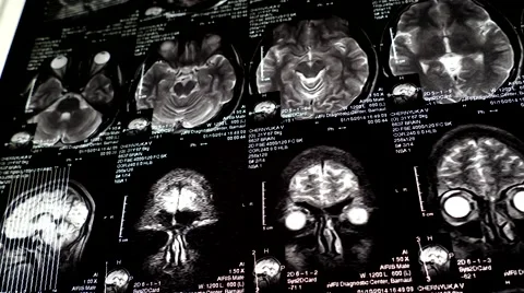 Computed tomography in motion Stock Footage 44620968