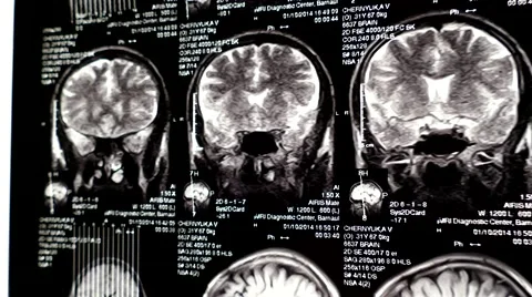 Computed tomography in motion Stock Footage 44621006