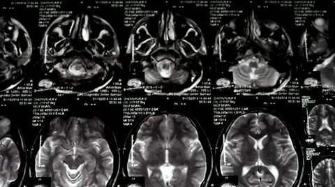 Computed tomography in motion Stock Footage 44621067