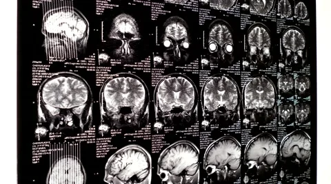 Computed tomography in motion Stock Footage 44621130