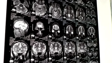 Computed tomography in motion Stock Footage 44621256