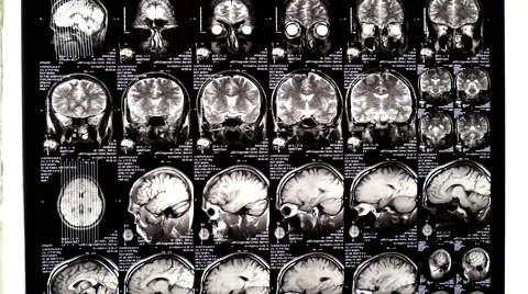 Computed tomography in motion Stock Footage 44621274