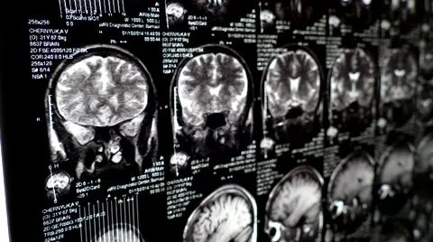 Computed tomography in motion gimbal shot Stock Footage 44620838