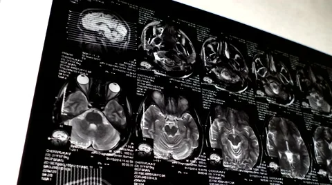 Computed tomography in motion slider shot Stock Footage 44620753