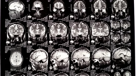 Computed tomography in motion slider shot Stock Footage 44621055