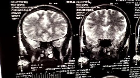 Computed tomography in motion slider zoom Stock Footage 44620629