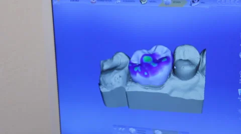 Computer automated 3D of teeth Stock Footage 50809544