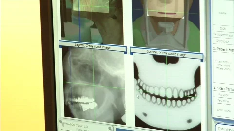 Computer dental x-ray tomography Stock Footage 646145