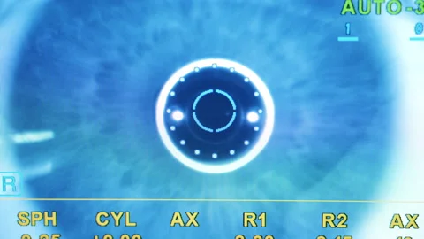 Computer display with an eye image on it Video stock 152614344