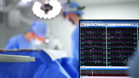Computer equipment in modern surgery room. Stock Footage 300112422