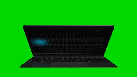 Computer functions with errors and malfunctions. Cardiogram of the sick heart Stock Footage 107087876