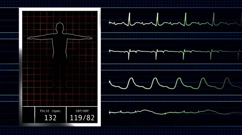 Computer Generated Heart Rate Medical Data Stock Footage 49473131