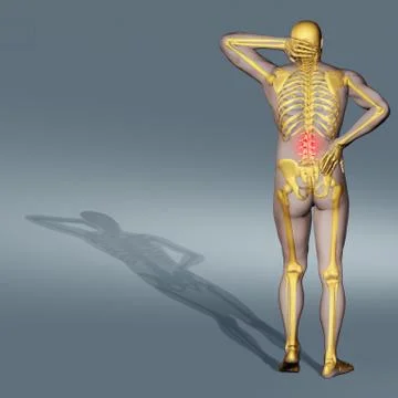 Computer-generated illustration of back pain Illustrazione stock