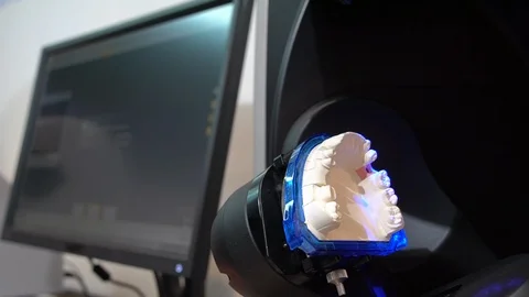 Computer Scanning Dental Mould Vídeos de archivo 92619156