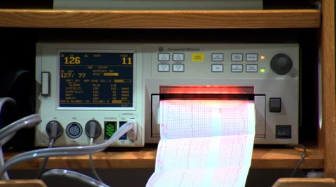 Computer screen and chart displaying pulse rate and blood pressure in a hospital Stock Footage